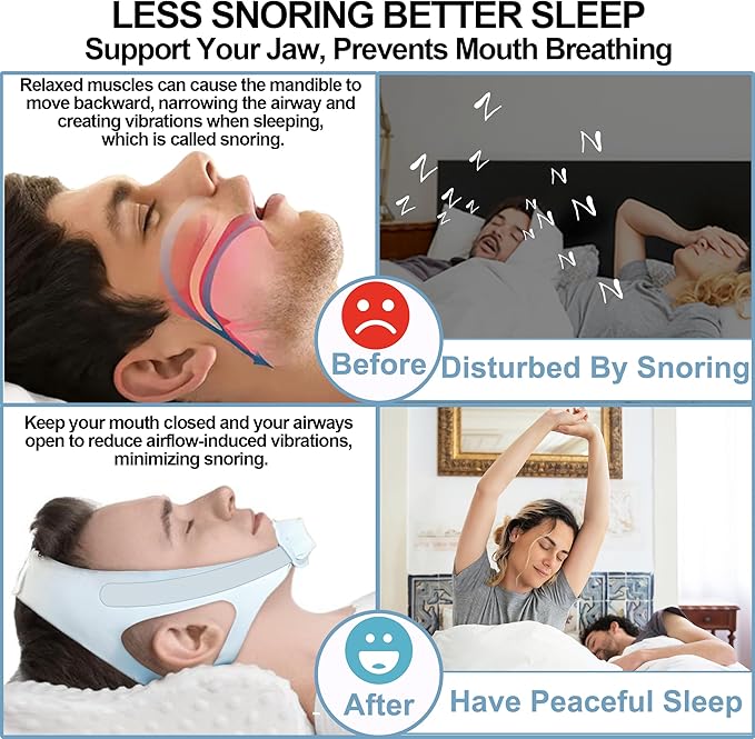 2 Pack Chin Strap for Sleeping - Effective Stop Snoring Solution - Adjustable Anti Snoring Chin Strap for Men Women Breathable Anti Snroing Devices