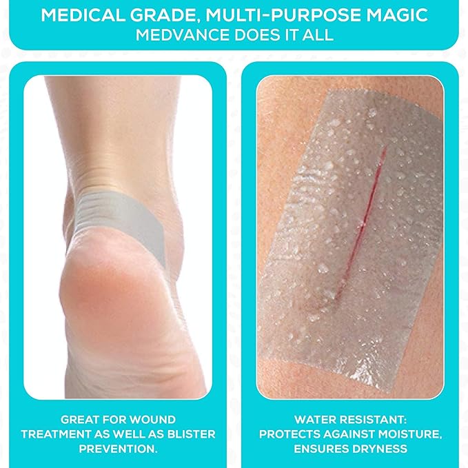 Medvance Soft Silicone Tape with Perforation for Easy Cut Size - 1" Width (1 Pack, 1.5 Yards)