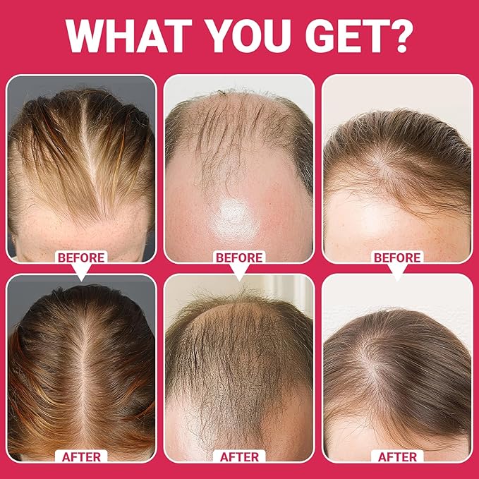 Laser Hair Growth Comb