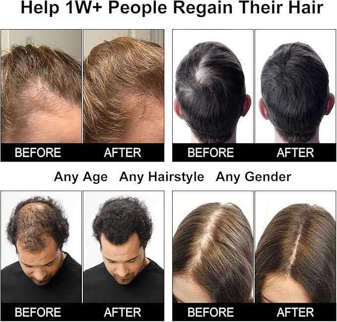 Red Light Therapy Hair Growth Cap, Laser Hair Growth Cap for Men and Women