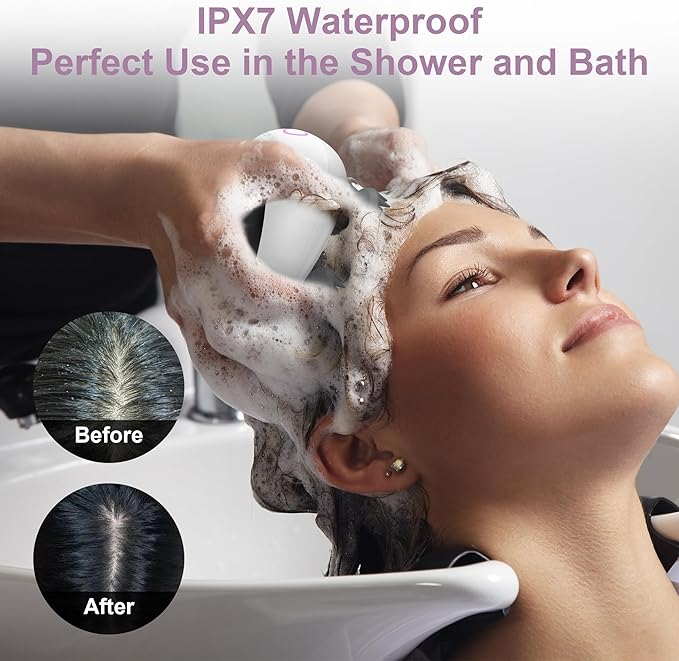 Electric Scalp Massager, Portable Head Stress Relax,IPX7 Waterproof Rechargeable Head Massager Scalp Stress Relax, Body for Deep Cleansing, Relief, Hair Growth (Black)